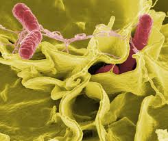 التسمم الغذائي Salmonella