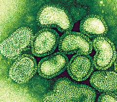  �Swine Flu: Analogies from the 