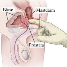 Foto di prostata - damebiraju