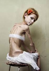 Foto di anorexia - wordpress