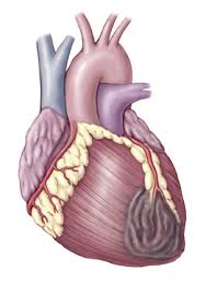 hyperlipidemia