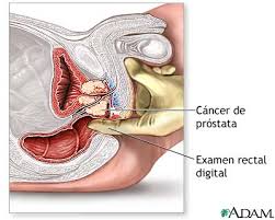 Foto di prostata - nih.gov