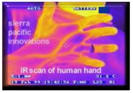  of vascular, muscle and cancer 