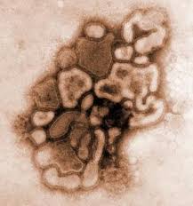  H1N1 virus