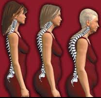 <h1>Osteoporoz – Kemik erimesi