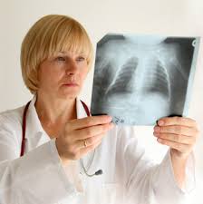 chest x-ray
