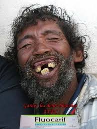 http://tbn3.google.com/images?q=tbn:yDlfc_nY3quxOM:accel12.mettre-put-idata.over-blog.com/0/15/50/94/dents_blanches.jpg