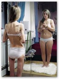 Foto di tesi anoressia - it