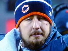 Kyle Orton Ankle Injury Status for