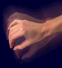 What is Causing Tremors in this Elderly Man’s Hand?