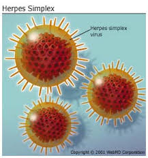 genital herpes facts
