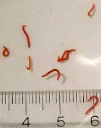 bloodworms.jpg