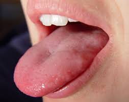 ....  tongue-180107_a.jpg